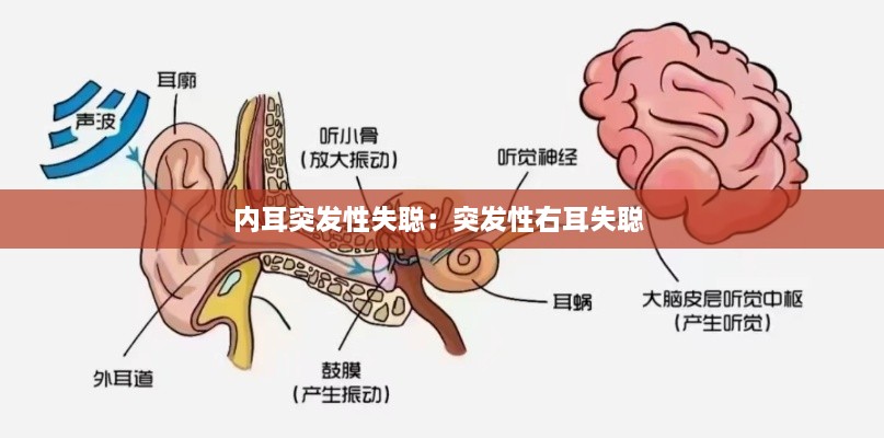 内耳突发性失聪：突发性右耳失聪 