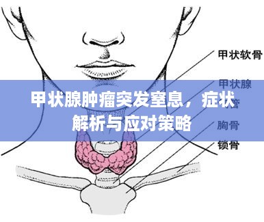 甲状腺肿瘤突发窒息，症状解析与应对策略