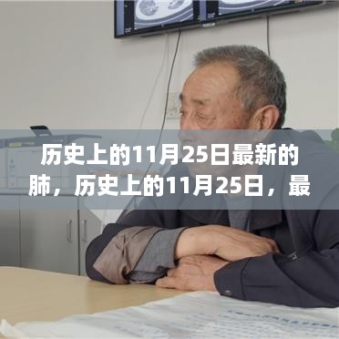 历史上的11月25日，最新肺技术革新深度解析与介绍