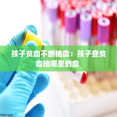 孩子贫血不断抽血：孩子查贫血抽哪里的血 