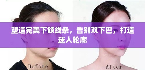 塑造完美下颌线条，告别双下巴，打造迷人轮廓